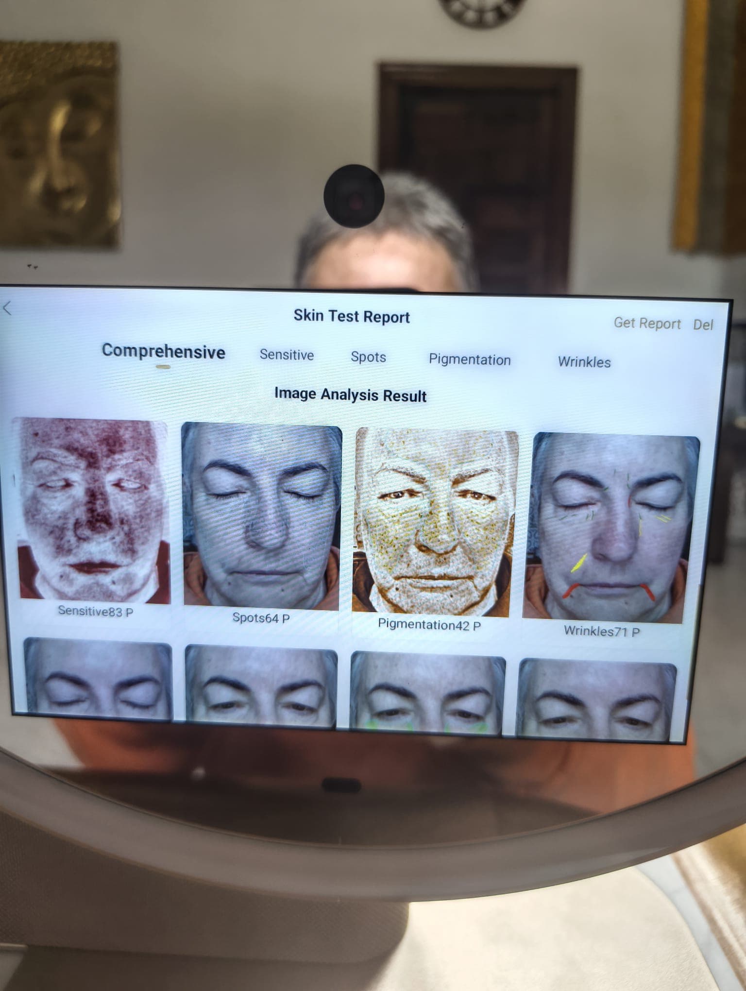 AI Skin Detection Mirror Report showing the visual of the 8 images it creates